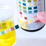 BANDELETTES URINAIRES 3 paramètres : Glucose - Protéine - Acétone