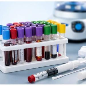 TUBES DE PRELEVEMENT